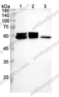 Anti-P4HB Polyclonal Antibody