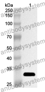 Anti-Human PSA/KLK3 Polyclonal Antibody