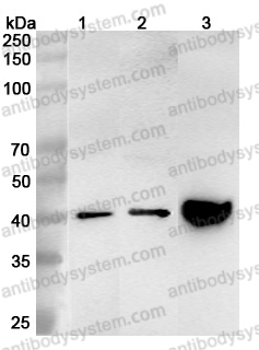 Anti-ASGR1 Polyclonal Antibody