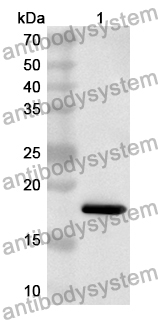 Anti-Human ASGR2 Polyclonal Antibody