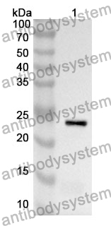 Anti-ADH1A Polyclonal Antibody