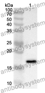 Anti-CTSD Polyclonal Antibody