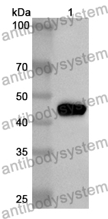 Anti-CTSD/Cathepsin D Polyclonal Antibody