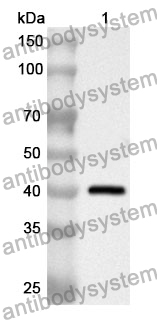 Anti-ANXA2 Polyclonal Antibody