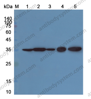 Anti-ANXA2 Polyclonal Antibody