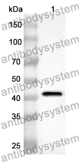 Anti-C8B Polyclonal Antibody