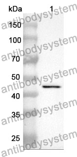 Anti-C8G Polyclonal Antibody