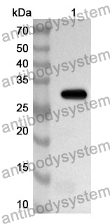 Anti-TUBB Polyclonal Antibody