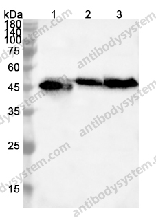 Anti-TUBB Polyclonal Antibody