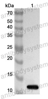 Anti-TUBB Polyclonal Antibody