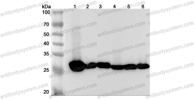 Anti-Human CA3/Carbonic anhydrase 3 Polyclonal Antibody