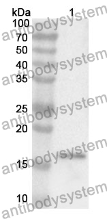 Anti-IVL Polyclonal Antibody