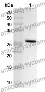 Anti-PRSS1 Polyclonal Antibody