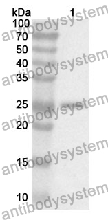 Anti-PRSS2 Polyclonal Antibody