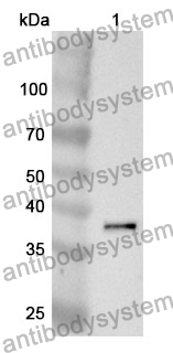 Anti-DCN Polyclonal Antibody