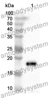 Anti-HEXB Polyclonal Antibody