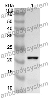 Anti-CTSL Polyclonal Antibody