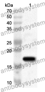 Anti-PFN1 Polyclonal Antibody