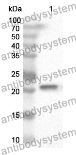 Anti-APRT Polyclonal Antibody