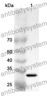 Anti-CTSB Polyclonal Antibody