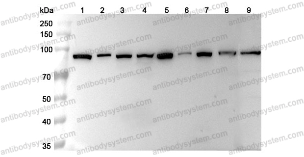 Anti-HSP90AA1 Polyclonal Antibody