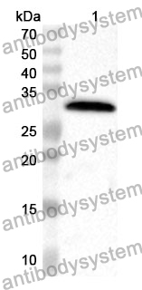 Anti-UMOD Polyclonal Antibody