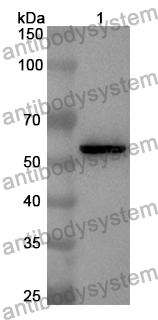 Anti-Human YES1 Polyclonal Antibody