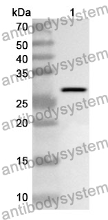 Anti-LYN Polyclonal Antibody