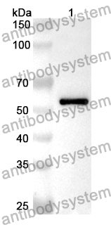 Anti-FH Polyclonal Antibody