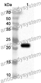 Anti-THBS1 Polyclonal Antibody