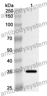 Anti-Human GJB1 Polyclonal Antibody