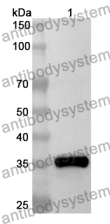 Anti-SP1 Polyclonal Antibody