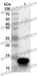 Anti-MSMB Polyclonal Antibody