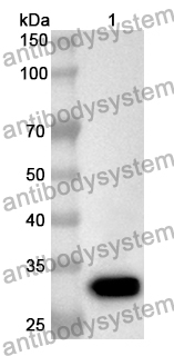 Anti-COL1A2 Polyclonal Antibody