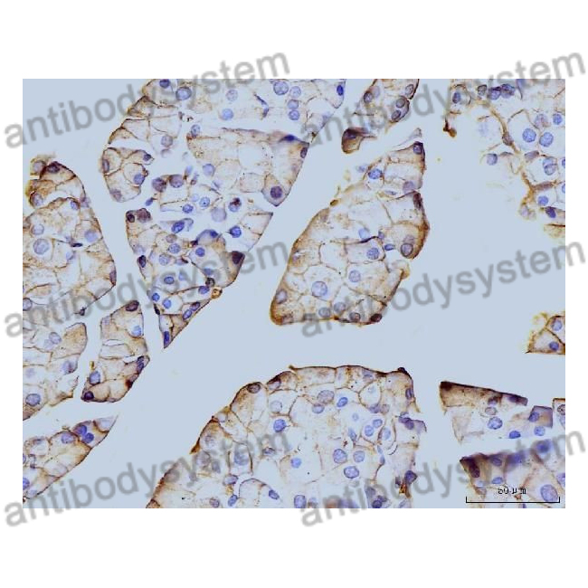 Anti-ANXA6 Polyclonal Antibody