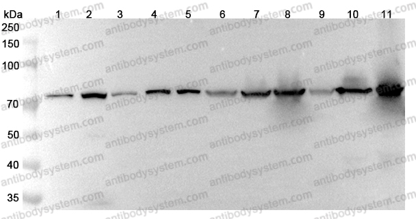 Anti-ANXA6 Polyclonal Antibody