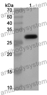 Anti-GLI1 Polyclonal Antibody