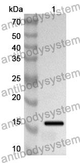 Anti-Human SERPINA6 Polyclonal Antibody