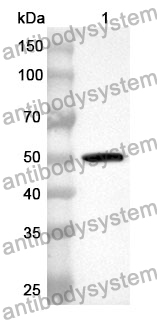 Anti-NR3C2 Polyclonal Antibody