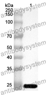 Anti-Human GUSB Polyclonal Antibody