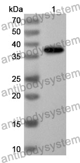 Anti-ASNS Polyclonal Antibody