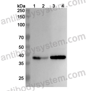 Anti-Human SYP/Synaptophysin Polyclonal Antibody