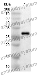 Anti-GSTA1 Polyclonal Antibody