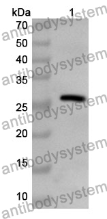 Anti-SOD3 Polyclonal Antibody