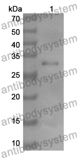 Anti-HMBS Polyclonal Antibody