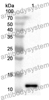 Anti-MGP Polyclonal Antibody