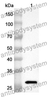 Anti-CD41/ITGA2B Polyclonal Antibody