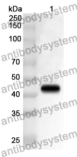 Anti-PDHA1 Polyclonal Antibody