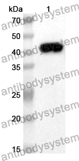 Anti-MYL3 Polyclonal Antibody