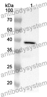 Anti-CFH Polyclonal Antibody